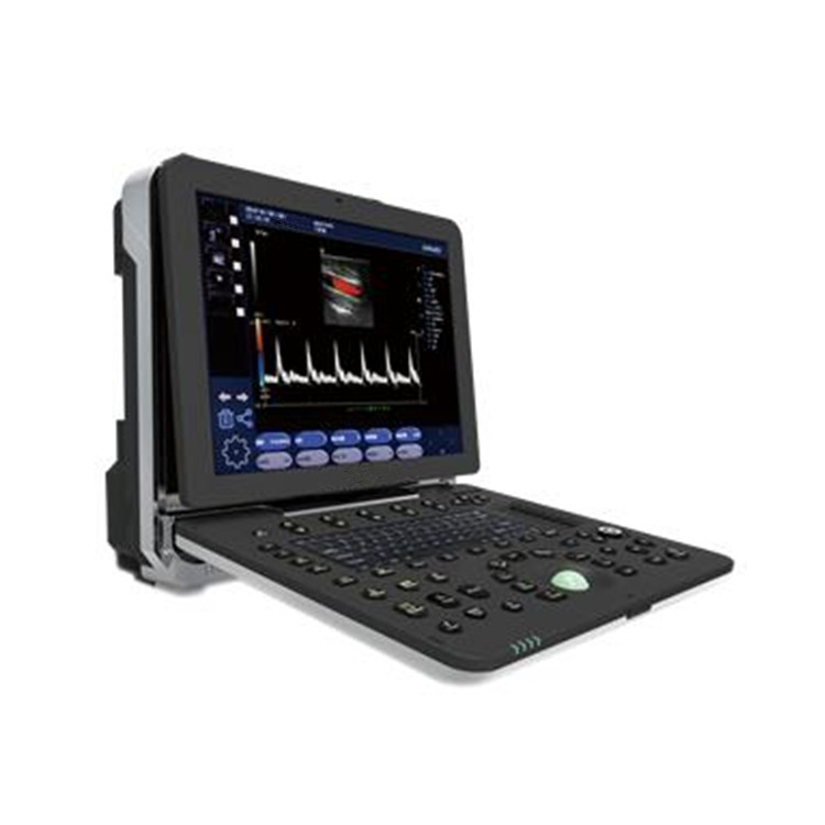 4D Color Echo Cardiac Ultrasound Diagnosis System