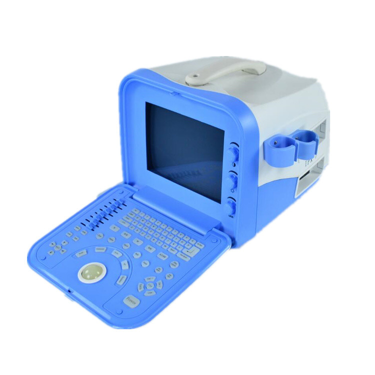 2D B/W Portable Ultrasound Diagnosis Machine