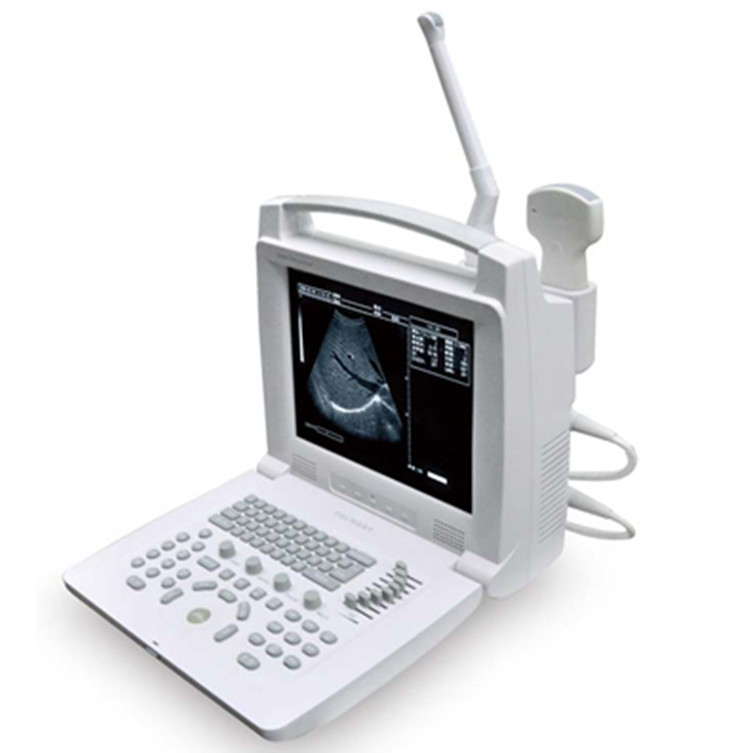 B/W Portable Ultrasound Scanner