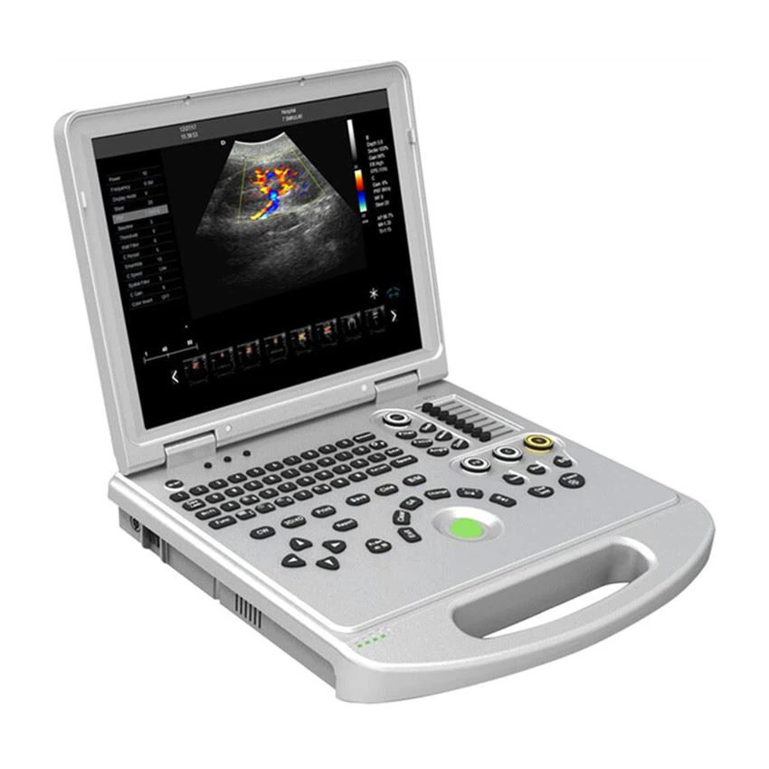 YJ-C60PLUS portable color doppler YJ-C60PLUS portable color doppler