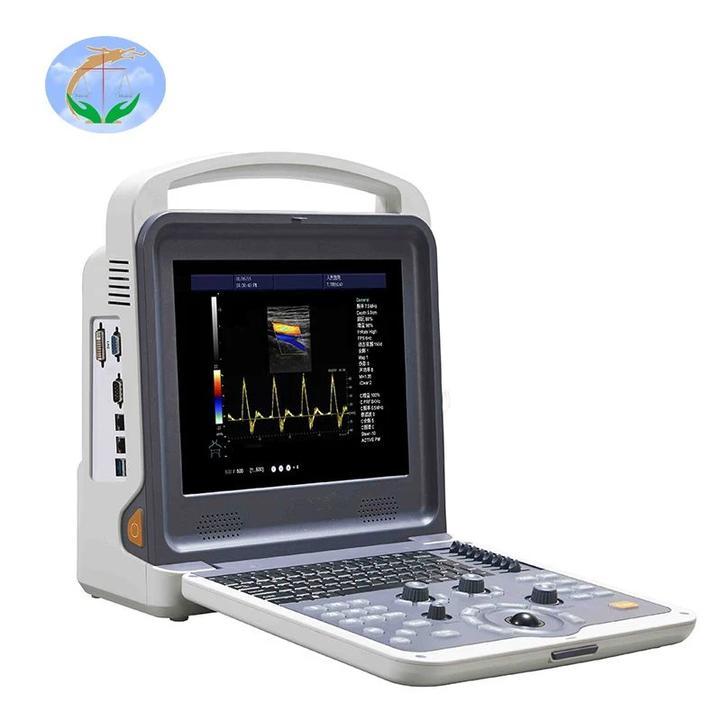 Color Doppler Ultrasound Color Doppler Ultrasound