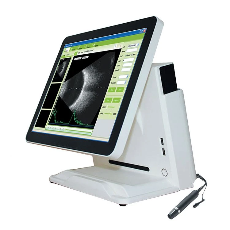 ophthalmology AB Ultrasound ophthalmology AB Ultrasound