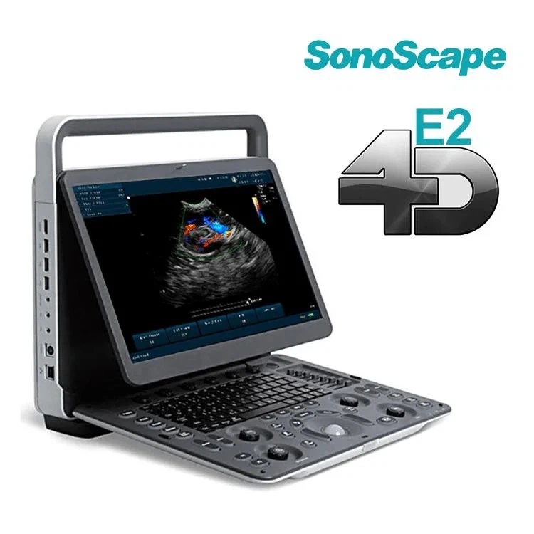 sonoscape e2 sonoscape e2