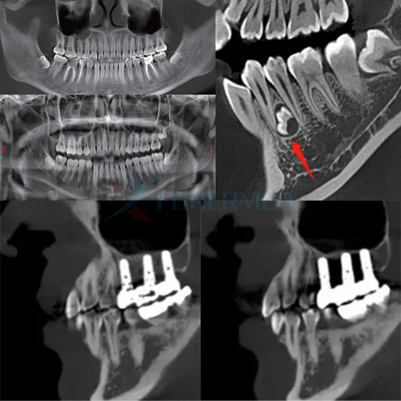 CBCT 3D Dental Imaging Center high quality CBCT 3D Dental Imaging Center high quality