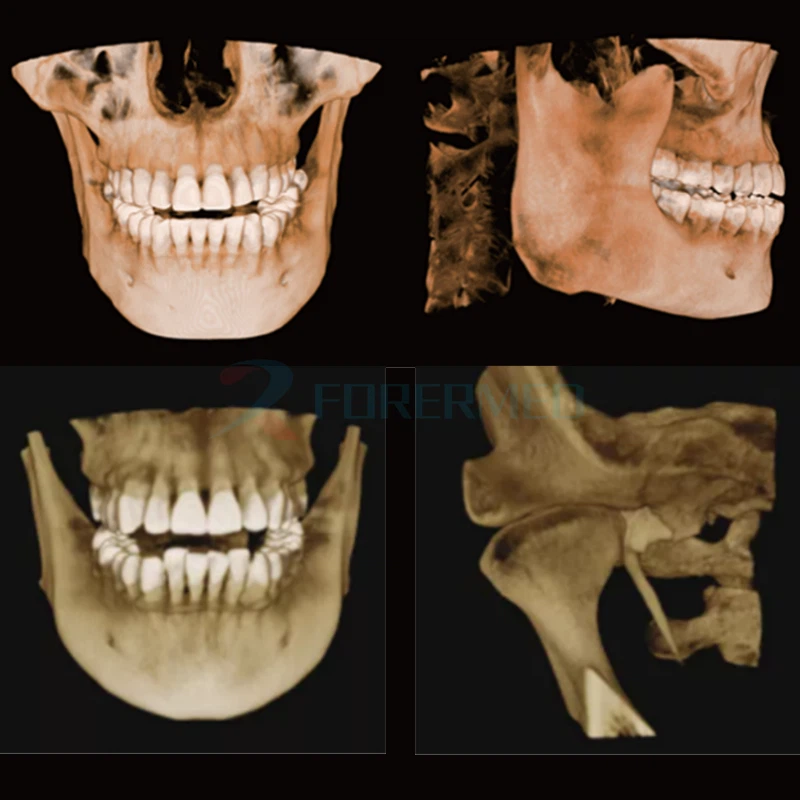 CBCT 3D Dental Imaging Center price CBCT 3D Dental Imaging Center price
