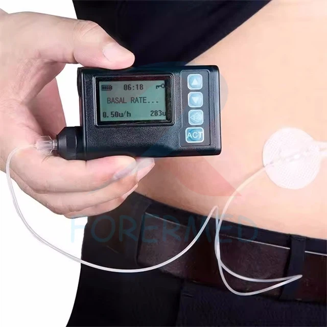 Insulin Infusion Pump