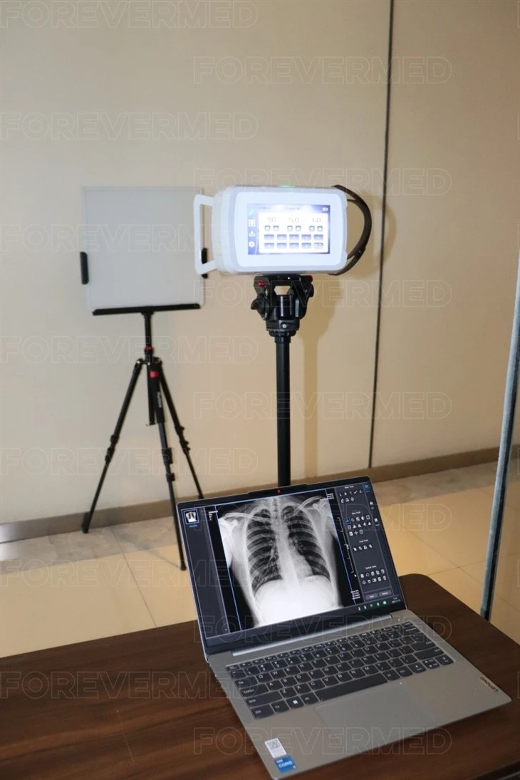 Portable 90KV X-Ray Machine
