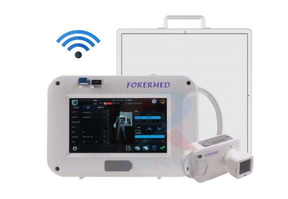 BW705 - hand held x ray BW705 - hand held x ray