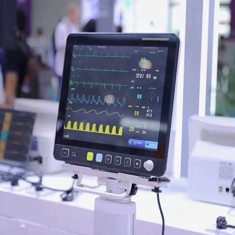 monitor vet monitor vet