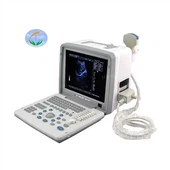 Full Digital UItrasound Diagnostic System