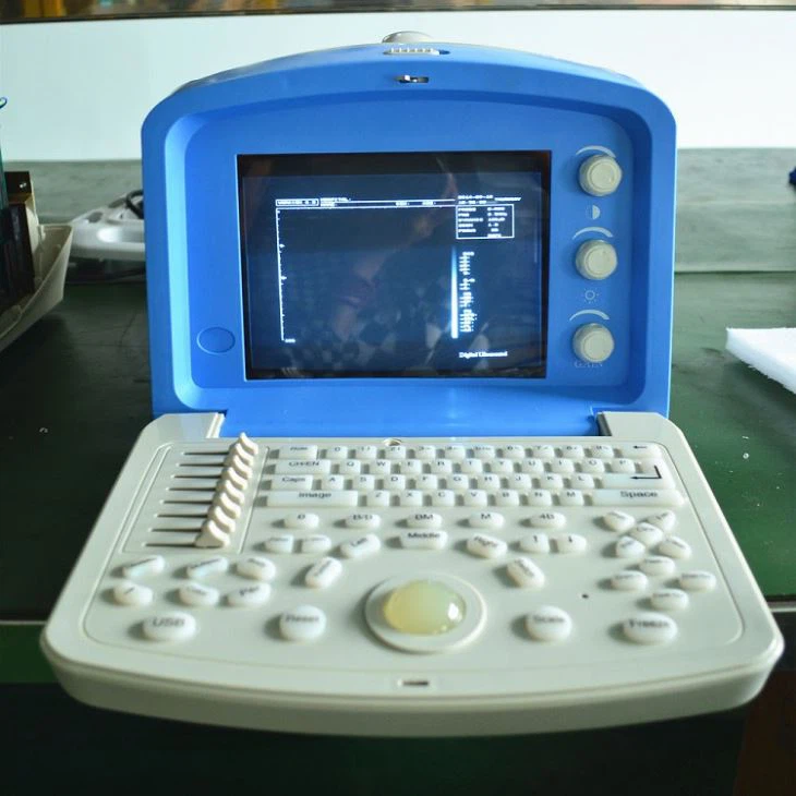 Portable Ultrasound System Scanner Portable Ultrasound System Scanner