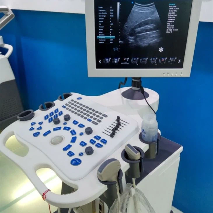 3D Trolley Color Ultrasound System Scanner