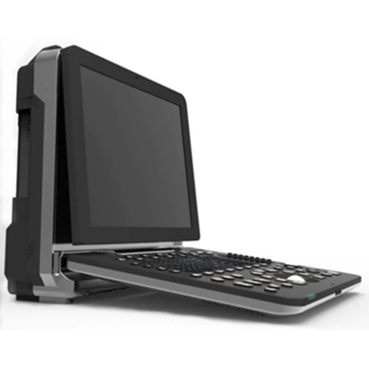 4D Color Echo Cardiac Ultrasound Diagnosis System 4D Color Echo Cardiac Ultrasound Diagnosis System
