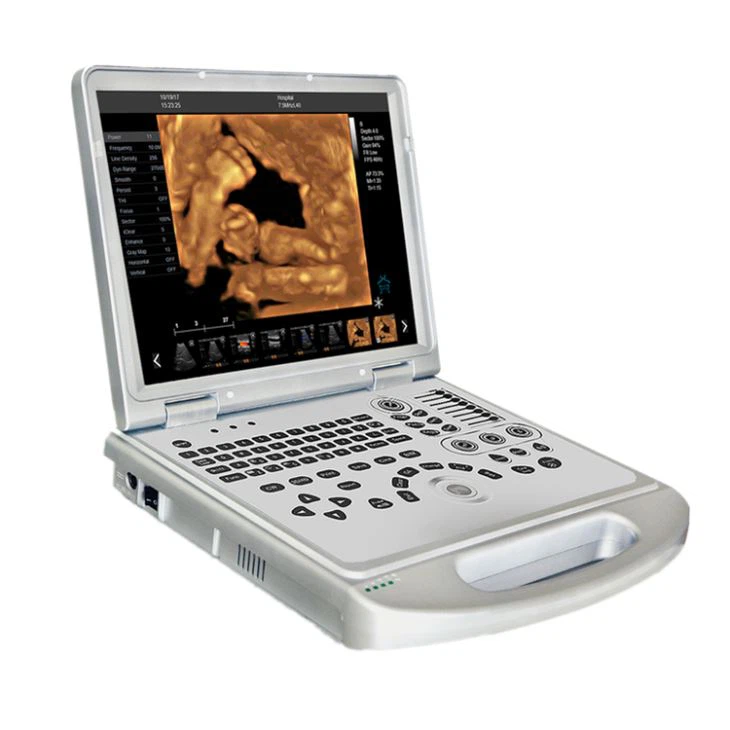 4D Color Ultraound Cardiac Scanner