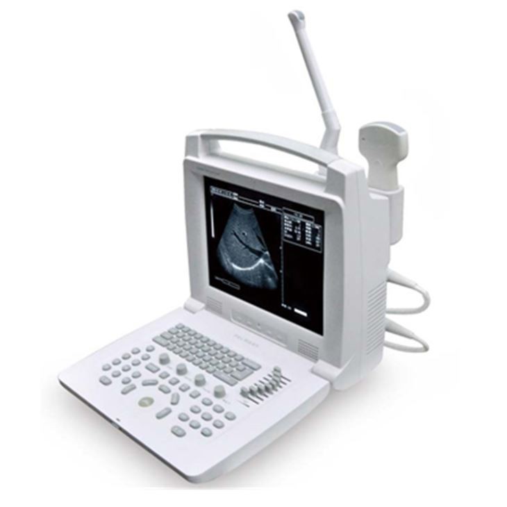 	B/W Portable Ultrasound Scanner