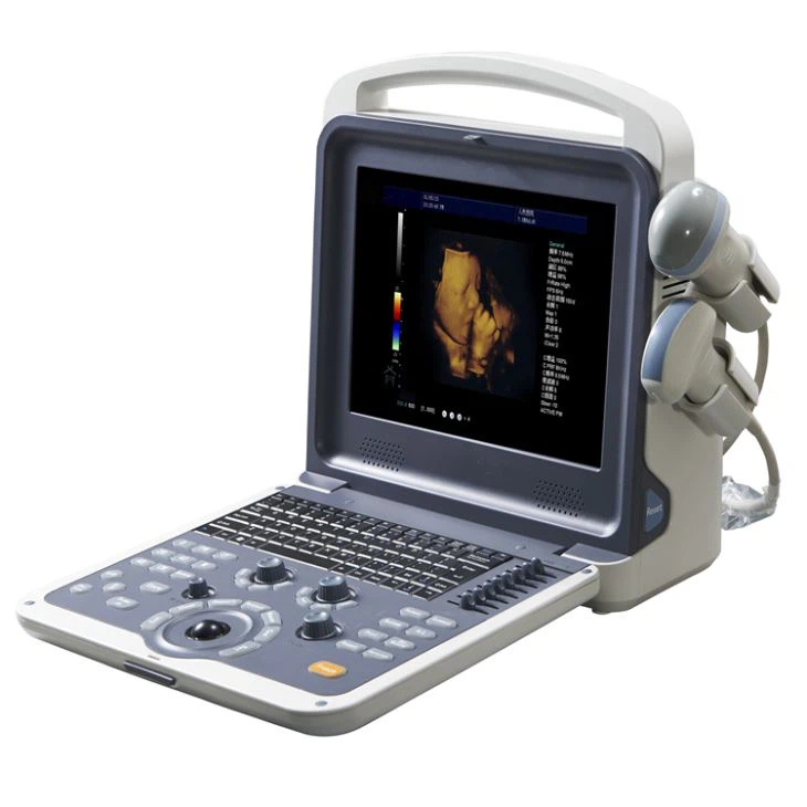Pediatrics Small Parts Ultrasound Scanner
