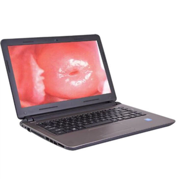 Portable Video Colpscope Portable Video Colpscope
