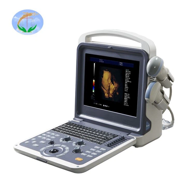 Medical Ultrasound Scanner