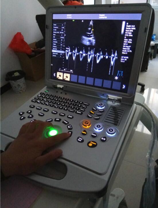 the difference between cardiac color dopler and ECG