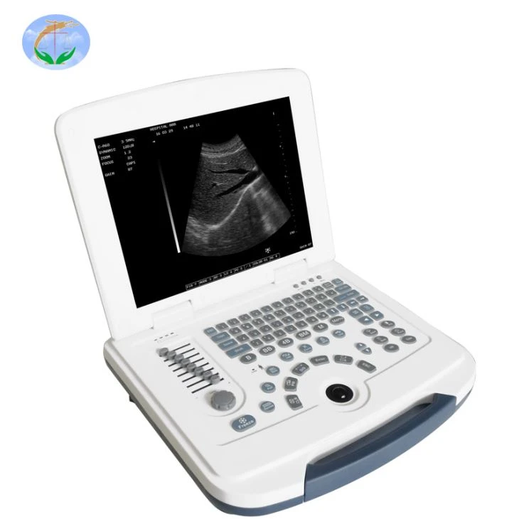 Portable Digital Ultrasound Machine