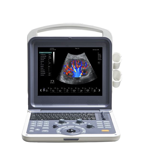 12 Inch LED Laptop 4D Olor Doppler Ultrasound Machine