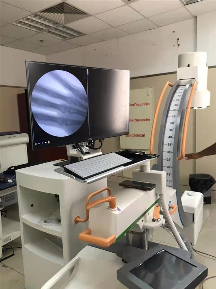 Digital C Arm X-ray Machine Digital C Arm X-ray Machine