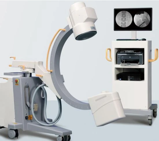 High Frequency Mobile Digital C-arm System