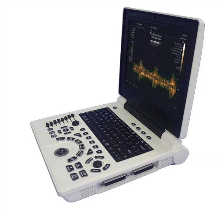 Portable Ultrsound Diagnostic System Portable Ultrsound Diagnostic System