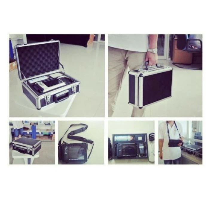 Small And Portable Veterinary Ultrasound Small And Portable Veterinary Ultrasound