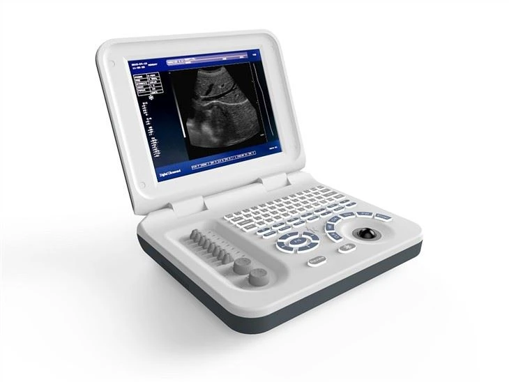 Full Digital LED Portable Ultrasound