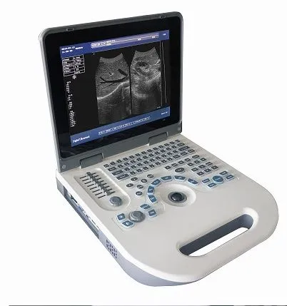 Full Digital Laptop Ultrasound