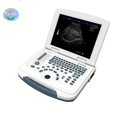 Full-Digital Laptop Ultrasound Scanner For Hospital And Clinic Full-Digital Laptop Ultrasound Scanner For Hospital And Clinic