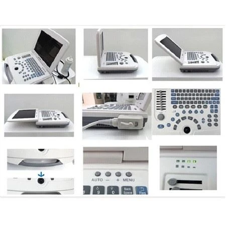 Full-Digital Laptop Ultrasound Scanner For Hospital And Clinic Full-Digital Laptop Ultrasound Scanner For Hospital And Clinic