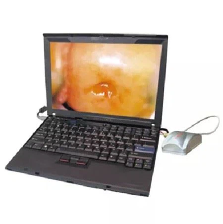 digital colposcope digital colposcope