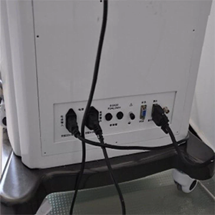 Black And WhiteTrolley Ultrasonic Scanner Pregancy Black And WhiteTrolley Ultrasonic Scanner Pregancy