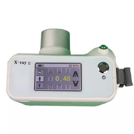 Portable Dental X Ray(YJ-DXP02) And Dental Sensor(YJ-HDR500) Solution