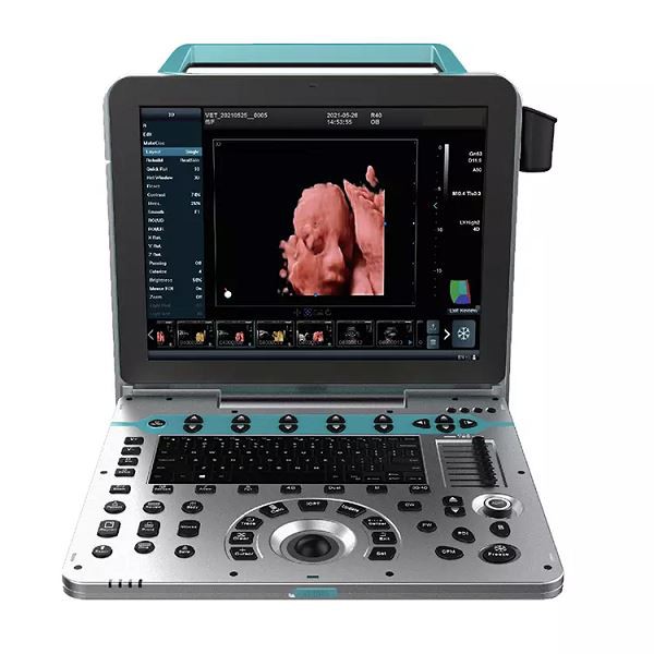 New Technoilogy 4D Ultrasound Diagnosis Machine YJ-C50