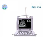 Portable Black And White Ultrasound Scanner (YJ-U318)