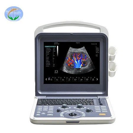 YJ-U60PLUS Color Doppler ——Full Digital Color Doppler Ultrasound Diagnostic System YJ-U60PLUS Color Doppler ——Full Digital Color Doppler Ultrasound Diagnostic System