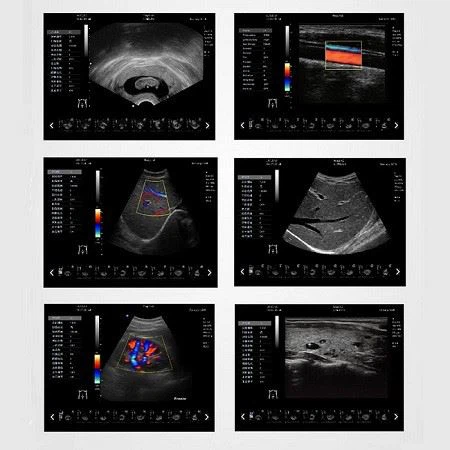 YJ-U60PLUS Color Doppler ——Full Digital Color Doppler Ultrasound Diagnostic System YJ-U60PLUS Color Doppler ——Full Digital Color Doppler Ultrasound Diagnostic System