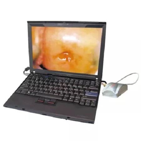 digital colposcope
