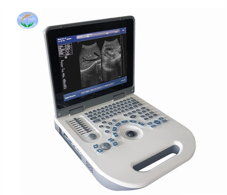 Full-Digital Black And White Laptop Ultrasound Scanner