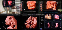 What is 5D (HD Live) Technology