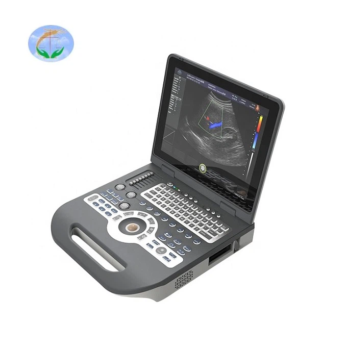 Notebook Color Doppler Ultrasound Scanner