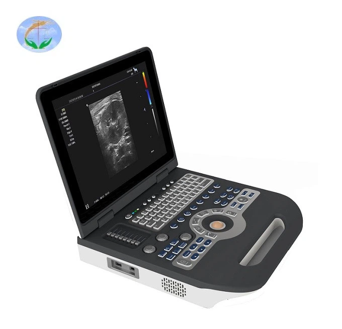 Notebook Color Doppler Ultrasound Scanner