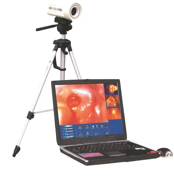 Electronic Dndoscope Video Color Digital Colposcope Sony