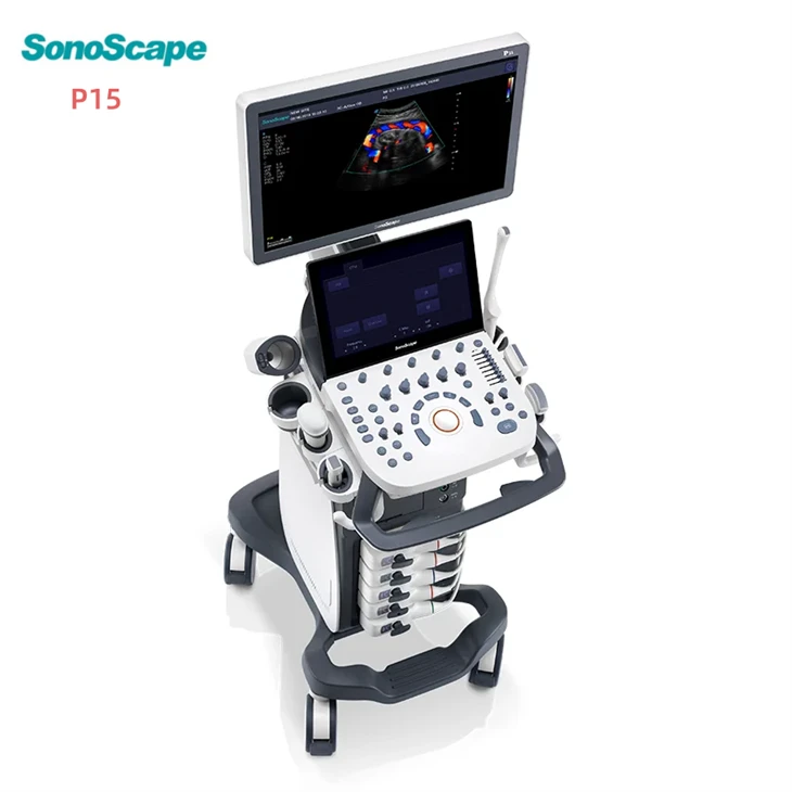 ultrasound